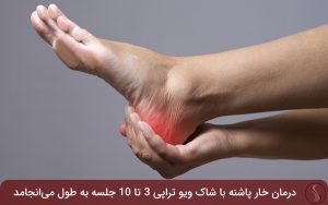 The number of treatment sessions for heel spurs with shock wave therapy